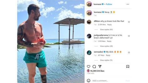 Viral Foto Kondisi Benjolan Di Kaki Lionel Messi Bikin Fans Khawatir