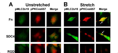 Myosin Light Chain Kinase Phosphorylation Antibody | Shelly Lighting