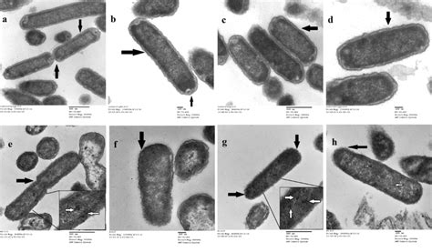 Transmission Electron Micrographs Of Reference Serovar Typhi Ty