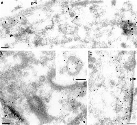 Immunoelectron Microscopic Localization Of Rab17 In Eph4 Cells