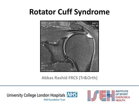 Rotator Cuff Syndrome Ppt