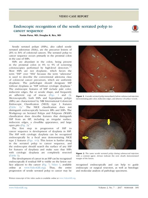 (PDF) Endoscopic recognition of the sessile serrated polyp to cancer ...