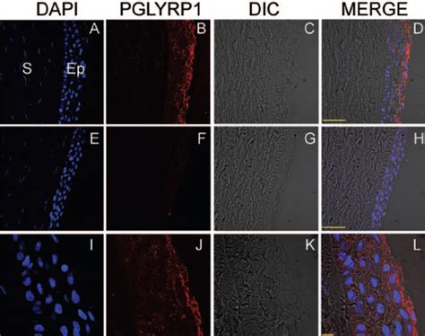 Immunohistology Showing PGLYRP1 Red Expression In The Human Corneal