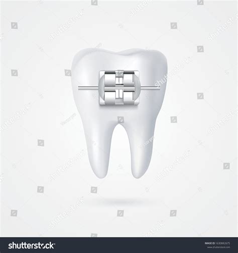 Vector Tooth Braces Illustration 3d Style White Royalty Free Stock