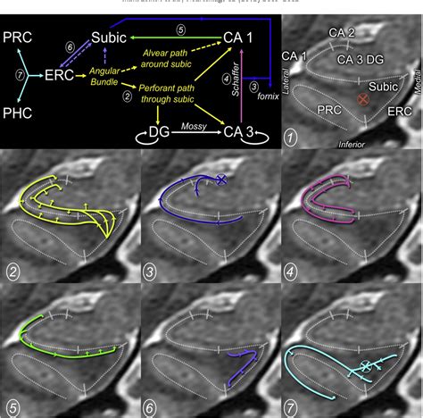 Figure 1 From Ultra High Resolution Diffusion Tensor Imaging Of The