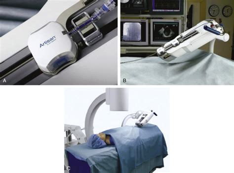 Remote Catheter Navigation Systems Thoracic Key