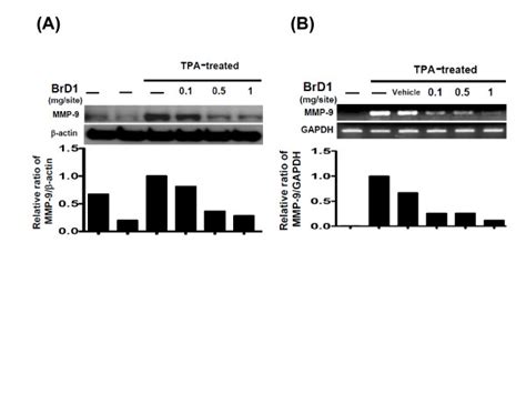 Brd1 Inhibits Tpa Induced Mmp 9 Expression In Mouse Skin A Abdominal