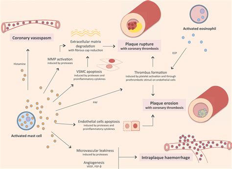 Role Of Allergic Inflammatory Cells In Coronary Artery Disease