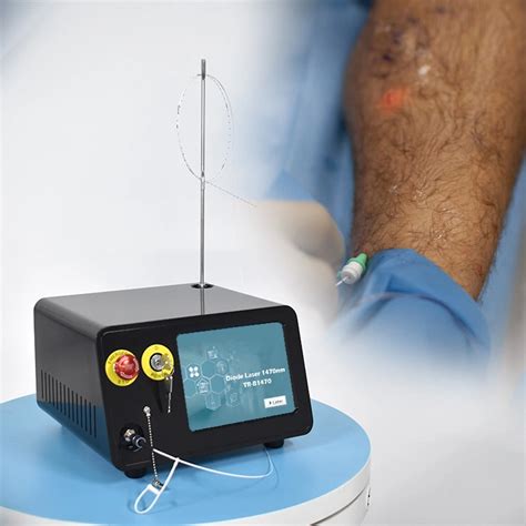 Flebologia Phlebology Laser 1470nm Evla Vascular Surgery Laser Ablation Varicose Veins Evlt