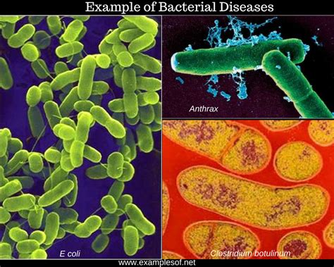 10 Examples Of Bacterial Diseases