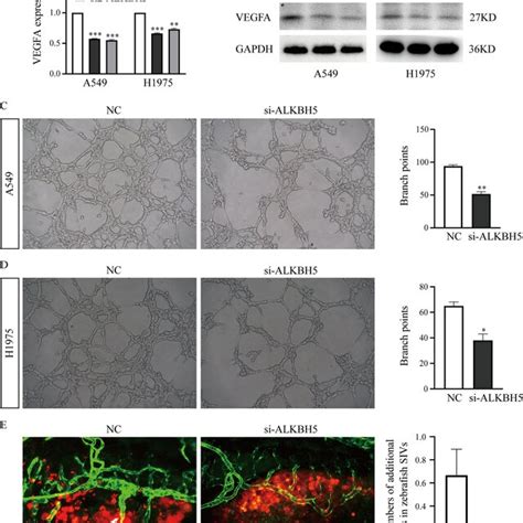 Knockdown Of Alkbh Inhibits The Angiogenesis Of Lung Cancer In Vitro