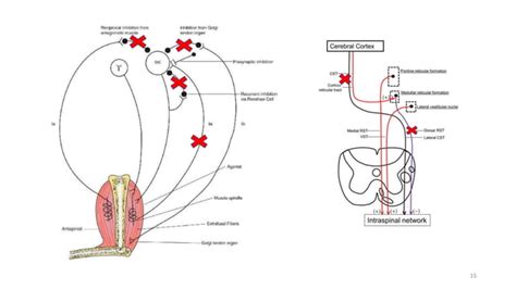 Pathophysiology Of Spasticity Ppt