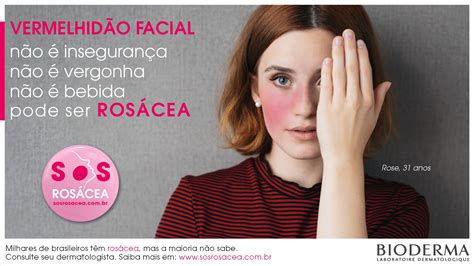 Bioderma Inicia Movimento De Conscientização Da Rosácea No Brasil Wepick