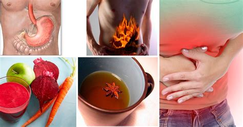 Что помогает от изжоги