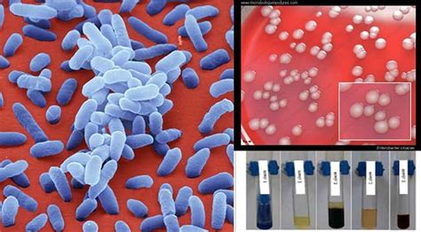 Biochemical Test Of Enterobacter Cloacae