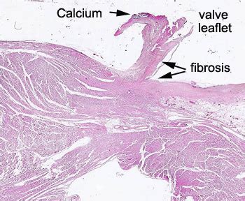 Heart Valve: Heart Valve Histology