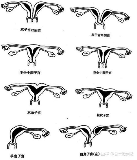 女性不孕的原因，这篇文章一次性全讲清楚！ 知乎