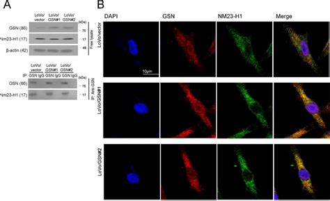 Gsn Immunoreactivity With Nm23 H1 Was Examined By Immunoblotting