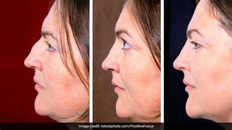 8 Best And Proven Face Exercises To Lose Weight In Your Face How To