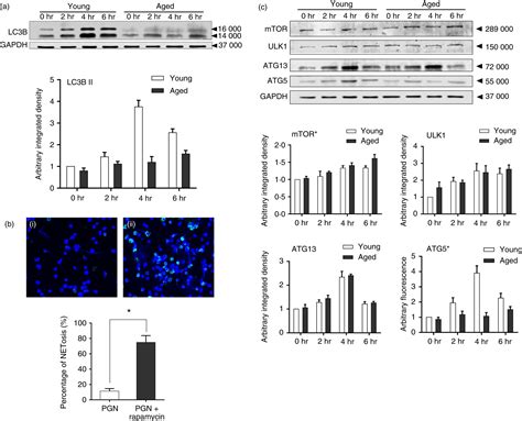 Agingrelated Atg Defect Impairs Neutrophil Extracellular Traps