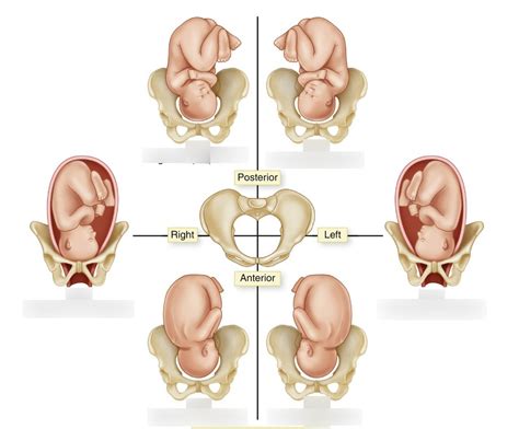 Fetal Positioning Diagram | Quizlet