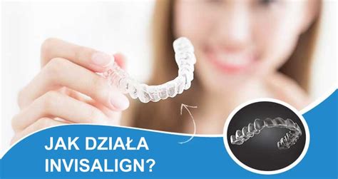 Ile Kosztuje Invisalign Inflancka