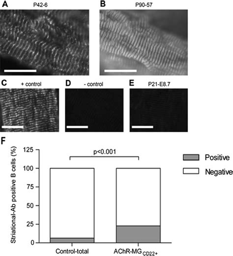 Immortalized Thymic B Cell Clones Produce Striational Antibodies