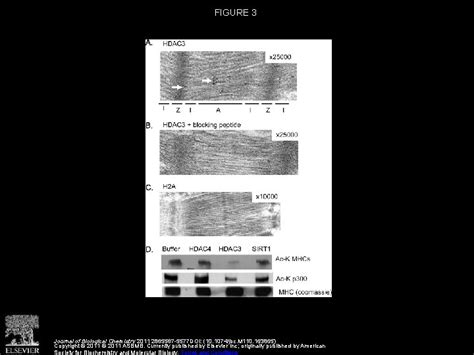 Hdac Dependent Reversible Lysine Acetylation Of Cardiac