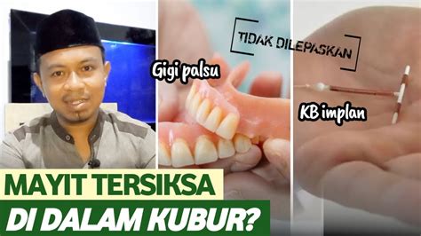 GIGI PALSU KB IMPLAN SUSUK TIDAK DILEPASKAN DARI MAYIT SAAT