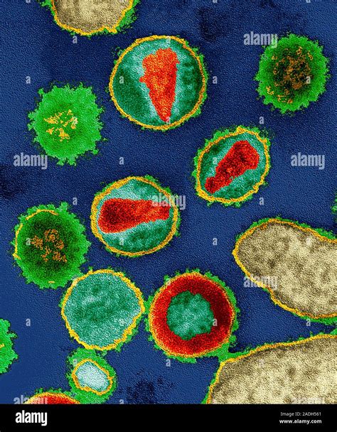 El VIH Color micrógrafo electrónico de transmisión TEM del virus de