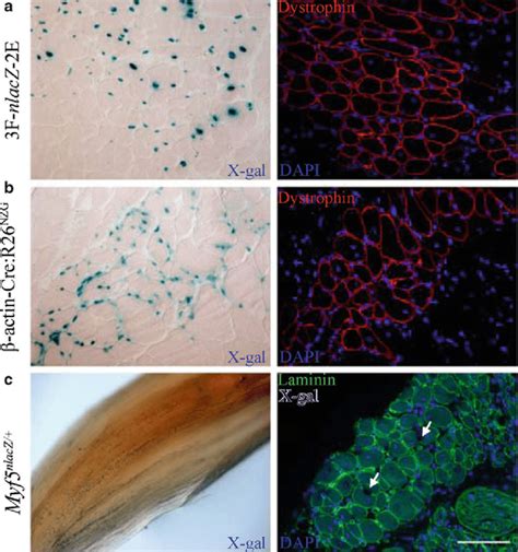 Detection Of Donor Derived Muscle Regeneration A When F Nlacz E