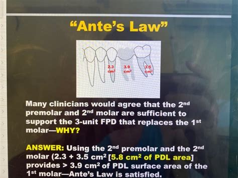 Lecture Abutment Selection Flashcards Quizlet