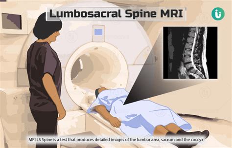 Lumbosacral (LS) spine MRI: Procedure, Purpose, Results, Cost, Price ...