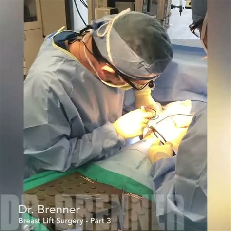 Breast Implant Removal Explantation Of Breast Implant Kevin Brenner Md Surgery Video 2