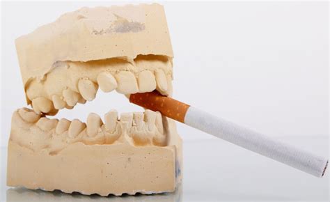 El Tabaco Y La Salud Bucodental