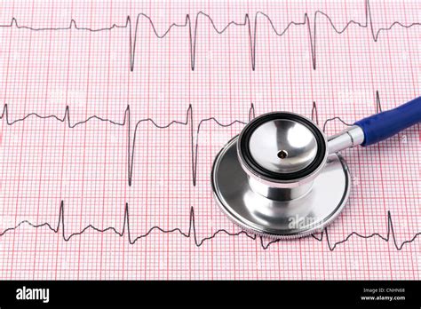 Photo Dun électrocardiogramme Ou Ecg Ekg Impression With Stethoscope