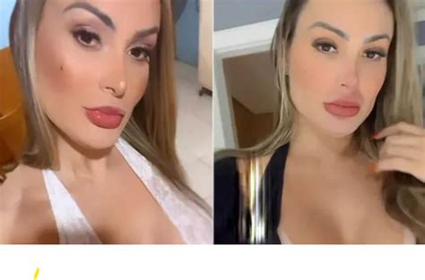 Ap S Fortes Dores Andressa Urach Precisou Ser Internada S Pressas