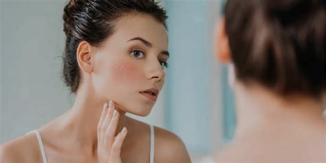 Derma Beauté Consejos Para Cuidar La Piel Sensible