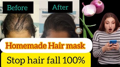 Diy Magical Hair Mask Gives Complete Hair Regrowth Stop Hair Fall