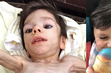 Emaciated Boy Makes Incredible Transformation After Hes Adopted He