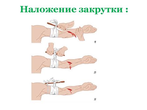 Первая помощь при кровотечениях - online presentation
