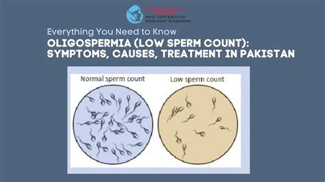 Oligospermia Low Sperm Count Symptoms Treatment In Pakistan