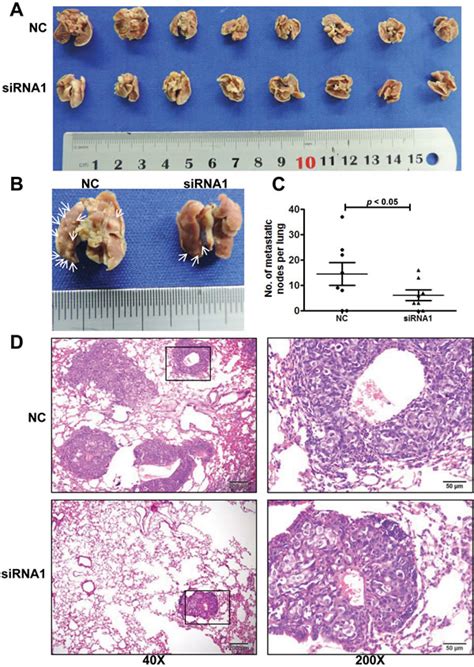 Upregulated Long Non Coding Rna Afap1 As1 Expression Is Associated With