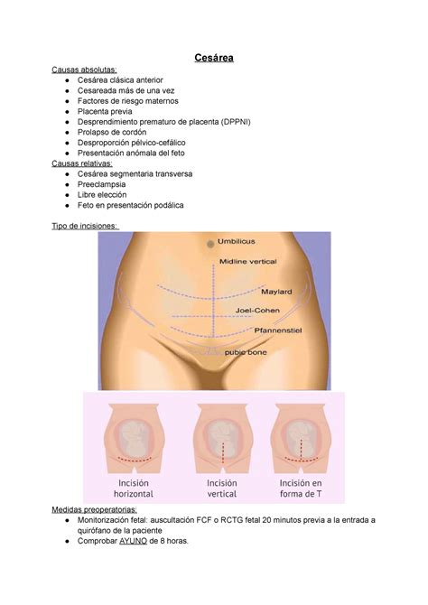 Cesarea Ces Rea Cuidados Antes Y Despu S De La Misma Ces Rea