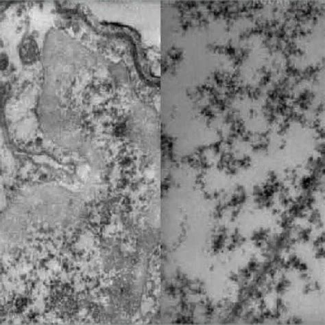 A: disorganized cristae and a tubulo vesicular internal structure. B ...