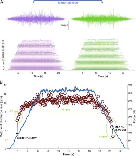 Motor Unit Discharge Characteristics And Conduction Velocity