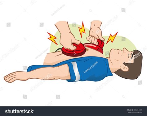 Illustration First Aid Resuscitation Cpr Using Stock Vector