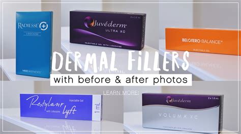 Dermal Fillers with Before & After Photos