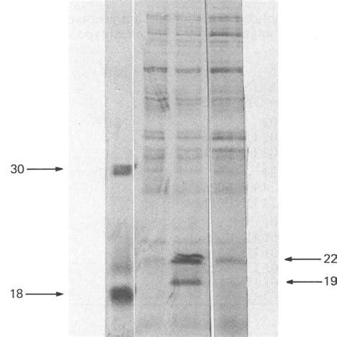 Autoradiogram Of Sds Polyacrylamide Gel Electrophoretogram Of