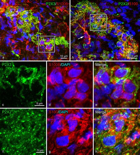 A Double Immunofluorescence For P2x3 And S100b In A Whole Mount